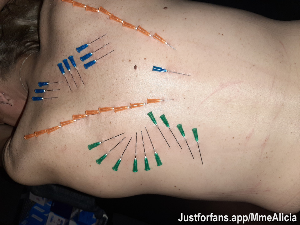 Needle play